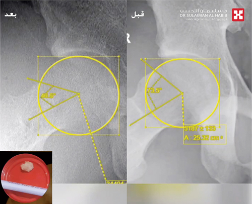 عاد لممارسة الرياضة 