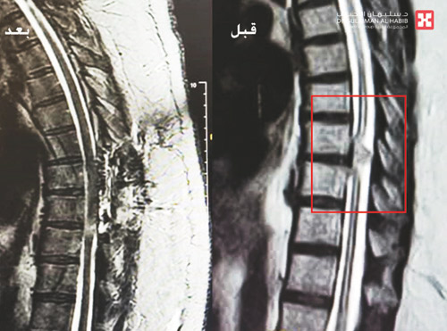 أقعد أربعينية عن الحركة 