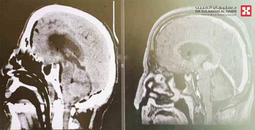 تمت والمريض في وضعية الجلوس 